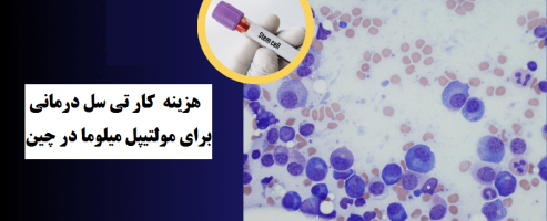 هزینه كار تي سل تراپي برای مولتیپل میلوما در چین: راهنمای جامع برای بیماران ایرانی