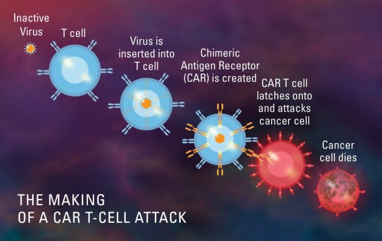  CAR T-Cell درمانی